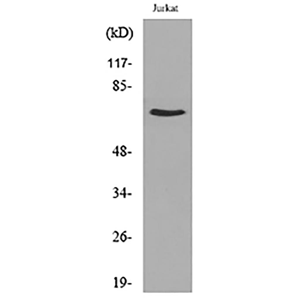 NFκB-p65 (Acetyl Lys218)兔多抗,NFκB-p65 (Acetyl Lys218) Rabbit Polyclonal Antibody