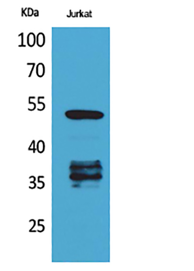 p53 (Acetyl Lys370)兔多抗,p53 (Acetyl Lys370) Rabbit Polyclonal Antibody