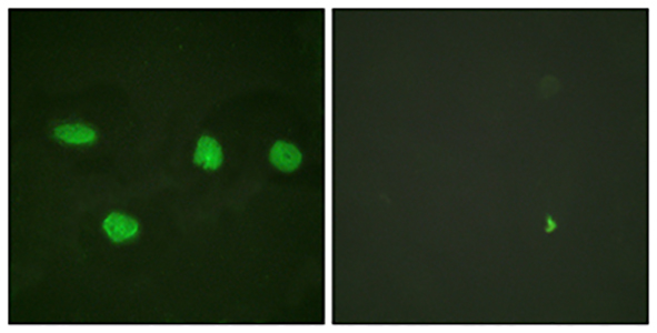 53BP1兔多抗,53BP1 Rabbit Polyclonal Antibody