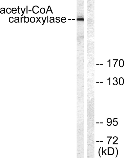 ACCα兔多抗,ACCα Rabbit Polyclonal Antibody