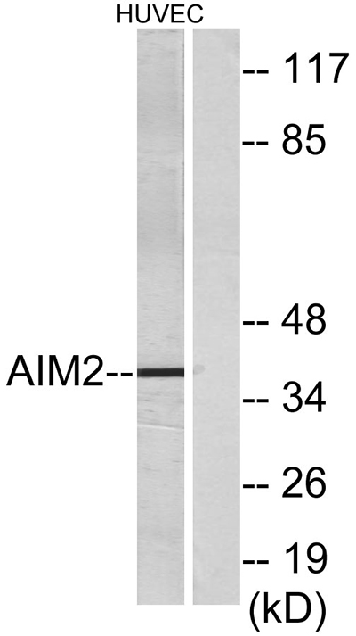 AIM2兔多抗,AIM2 Rabbit Polyclonal Antibody