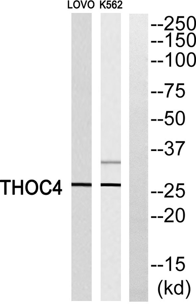 ALY兔多抗,ALY Rabbit Polyclonal Antibody