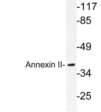 Annexin II兔多抗,Annexin II Rabbit Polyclonal Antibody
