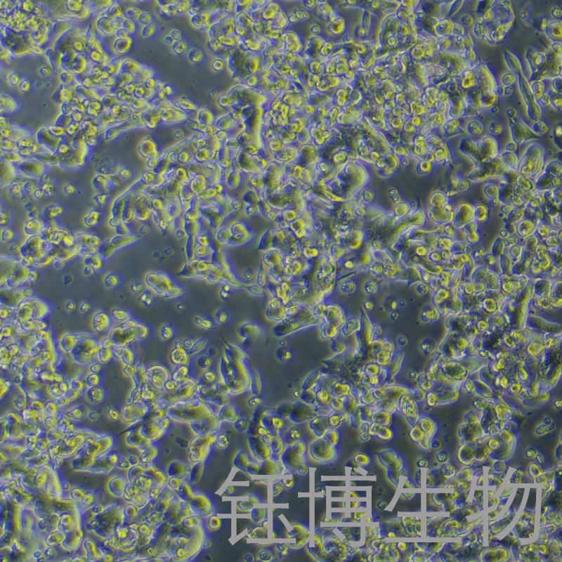 IM95m（人胃癌细胞）YB-72026HC,IM95m