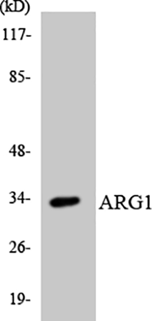 Arginase I兔多抗,Arginase I Rabbit Polyclonal Antibody