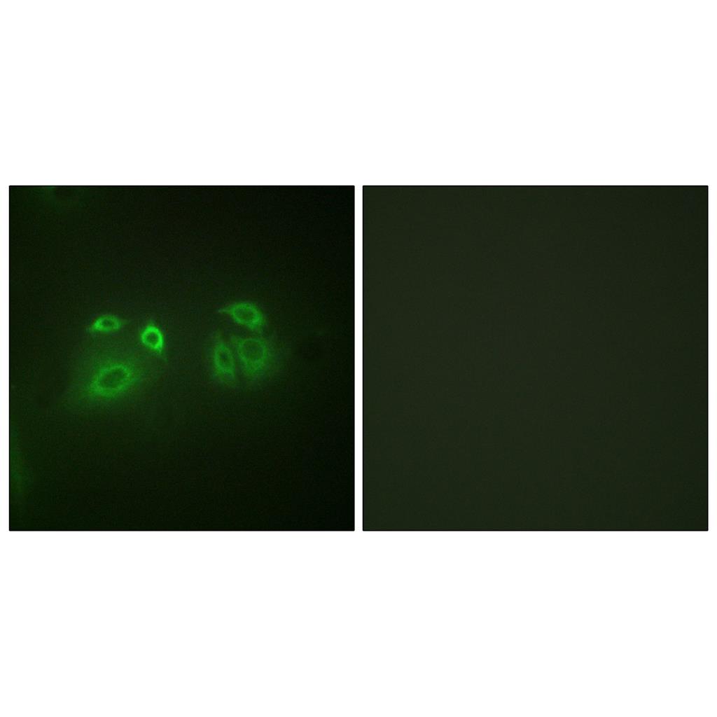 Arrestin-β-1兔多抗,Arrestin-β-1 Rabbit Polyclonal Antibody