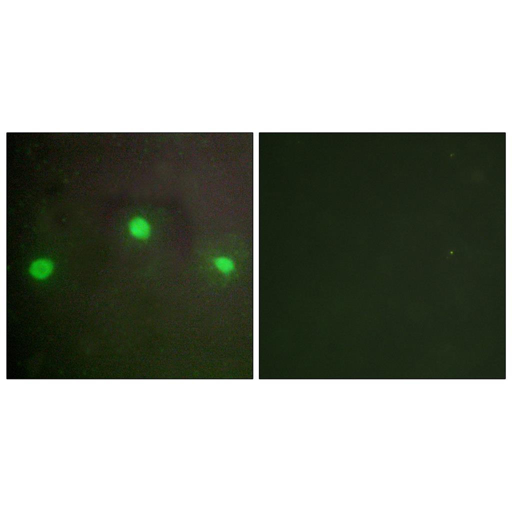 ATRX兔多抗,ATRX Rabbit Polyclonal Antibody