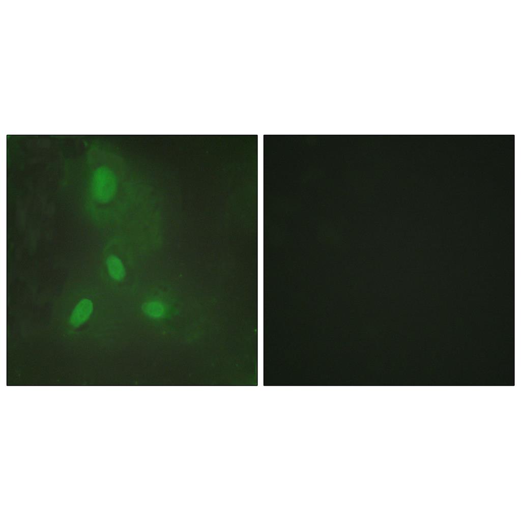 BACH1兔多抗,BACH1 Rabbit Polyclonal Antibody