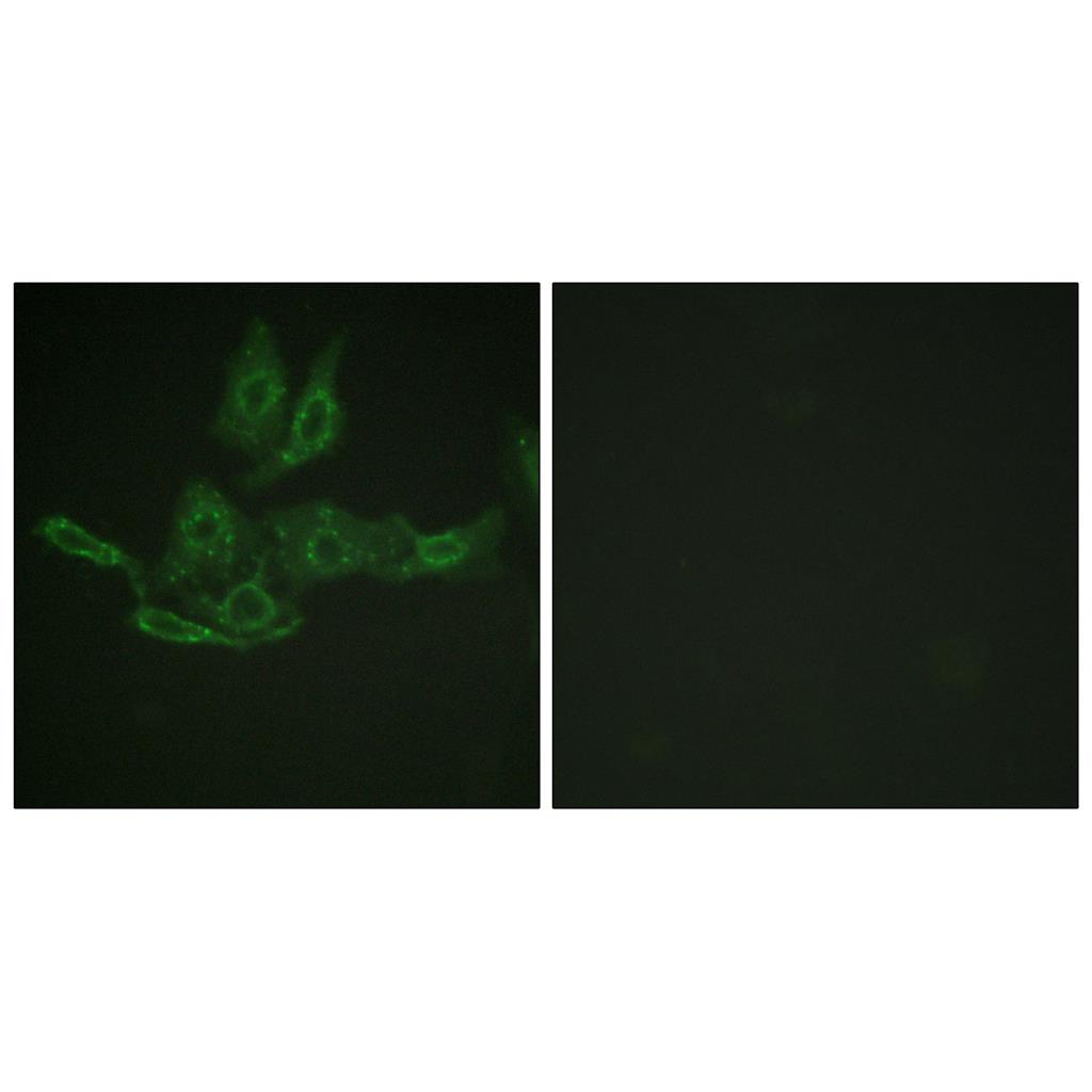 Bcl-2兔多抗,Bcl-2 Rabbit Polyclonal Antibody