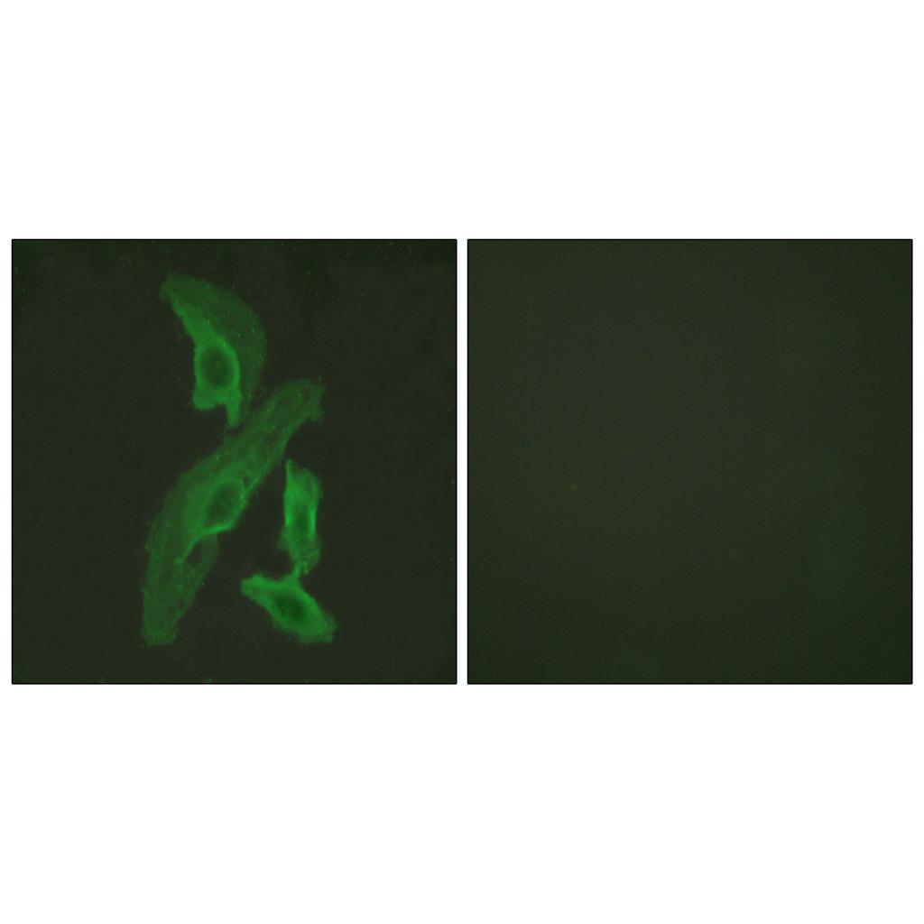 Bcl-x兔多抗,Bcl-x Rabbit Polyclonal Antibody