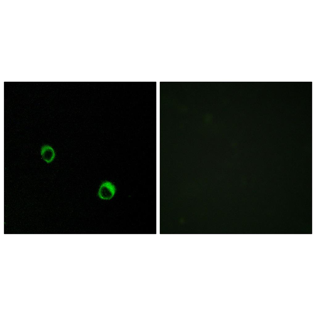 CARD 14兔多抗,CARD 14 Rabbit Polyclonal Antibody