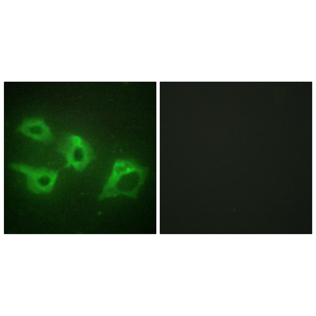 Casein Kinase Iα兔多抗,Casein Kinase Iα Rabbit Polyclonal Antibody