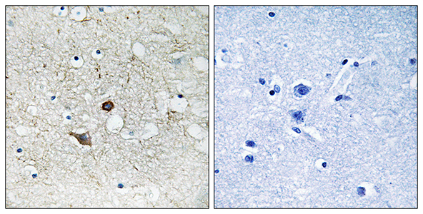 Caspase-2兔多抗,Caspase-2 Rabbit Polyclonal Antibody
