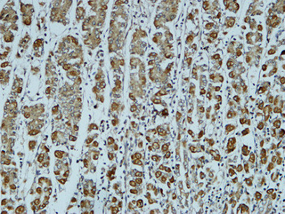 Catenin-α1兔多抗,Catenin-α1 Rabbit Polyclonal Antibody