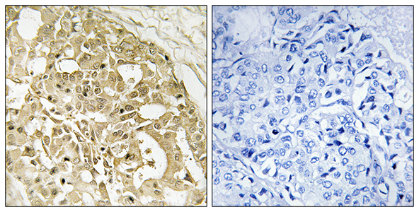 Catenin-β兔多抗,Catenin-β Rabbit Polyclonal Antibody