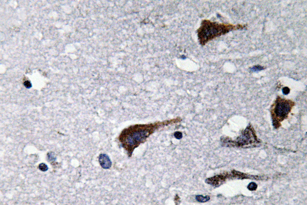 Cathepsin B兔多抗,Cathepsin B Rabbit Polyclonal Antibody