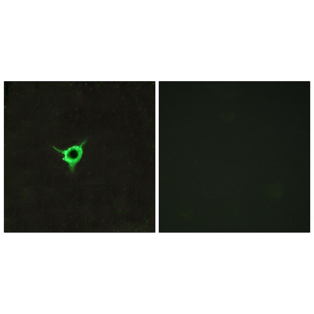 CB1兔多抗,CB1 Rabbit Polyclonal Antibody