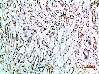 CD151兔多抗,CD151 Rabbit Polyclonal Antibody