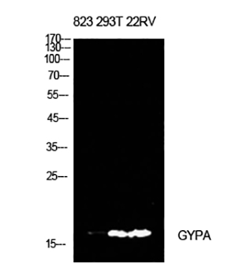 CD235a兔多抗,CD235a Rabbit Polyclonal Antibody