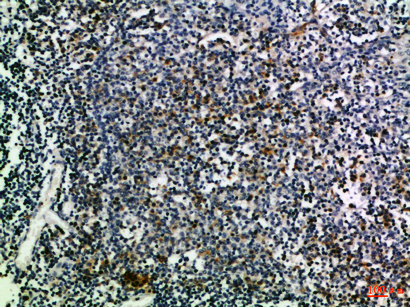 CD274兔多抗,CD274 Rabbit Polyclonal Antibody