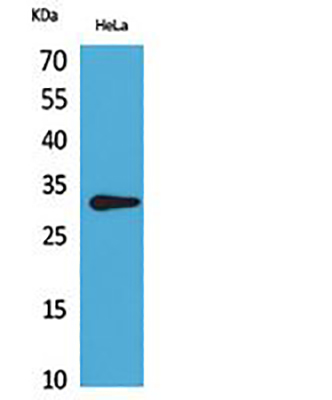 CD37兔多抗,CD37 Rabbit Polyclonal Antibody
