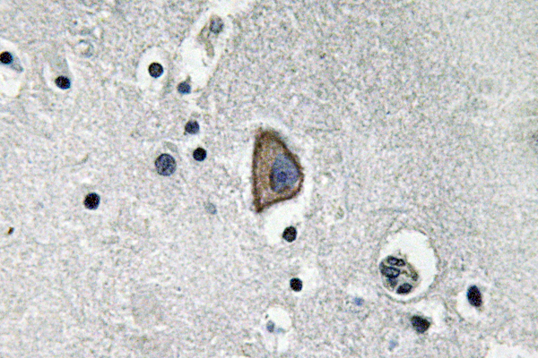 CD3-ε兔多抗,CD3-ε Rabbit Polyclonal Antibody