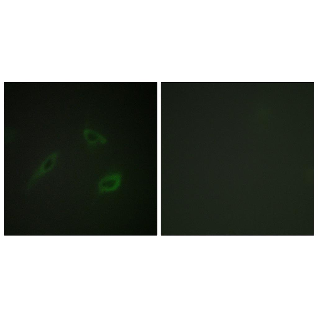 CD4兔多抗,CD4 Rabbit Polyclonal Antibody