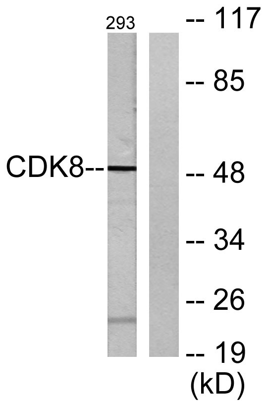 Cdk8兔多抗,Cdk8 Rabbit Polyclonal Antibody