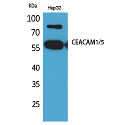 CEACAM1/5兔多抗,CEACAM1/5 Rabbit Polyclonal Antibody
