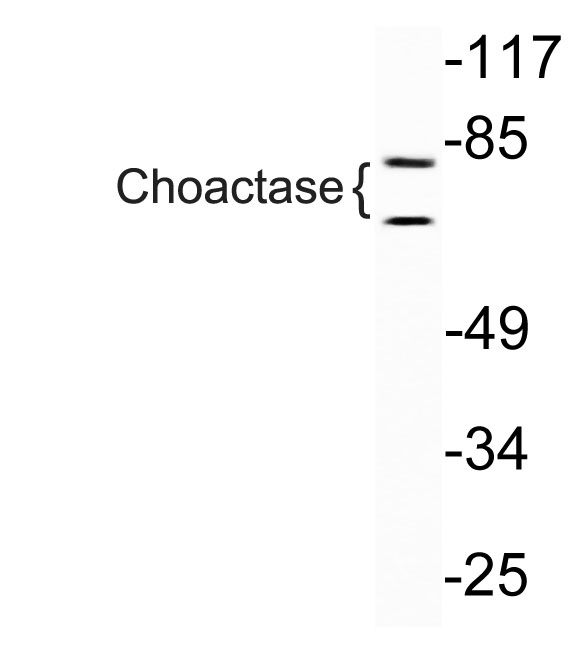 Choactase兔多抗,Choactase Rabbit Polyclonal Antibody