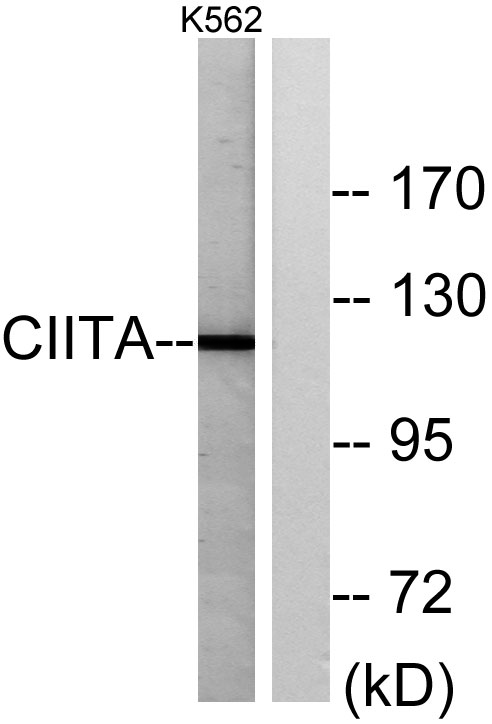 CIITA兔多抗,CIITA Rabbit Polyclonal Antibody