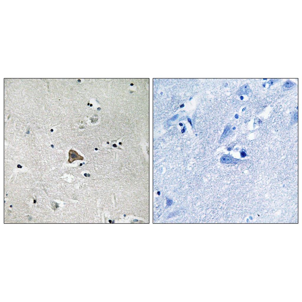 Claudin-4兔多抗,Claudin-4 Rabbit Polyclonal Antibody