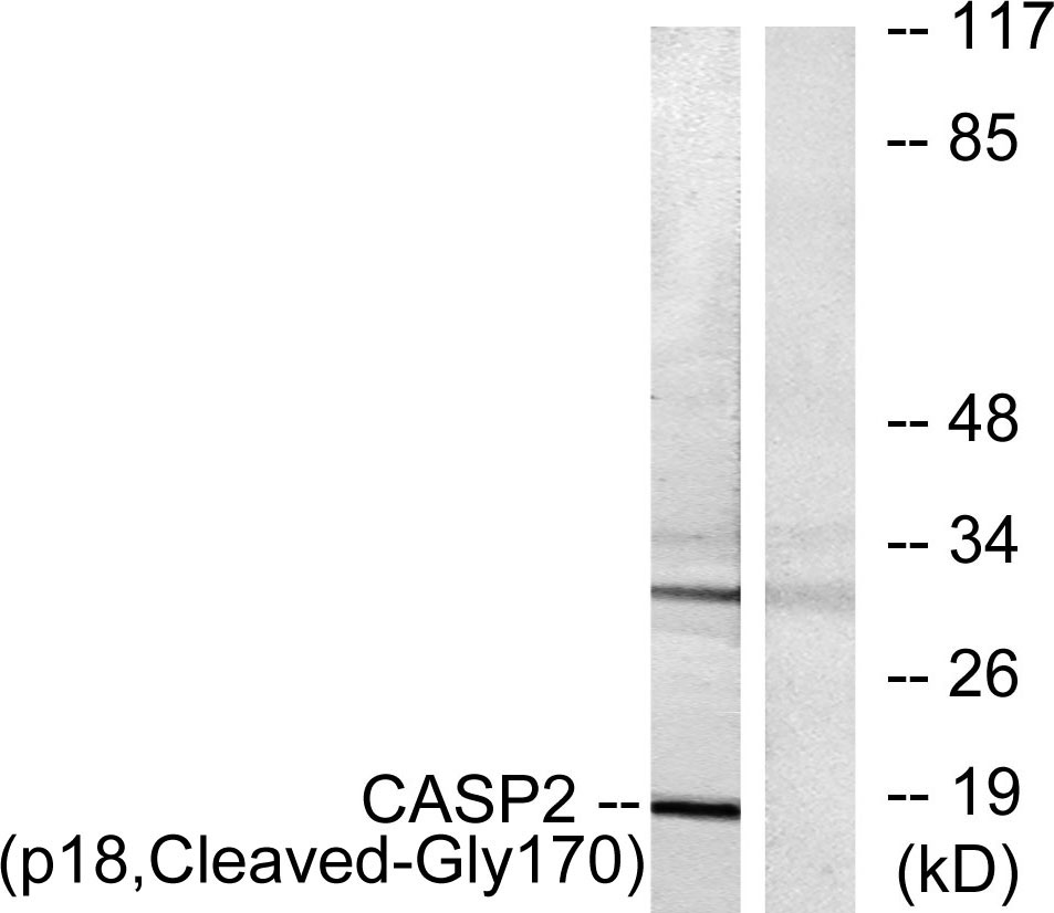 Cleaved-Caspase-2 p18 (G170)兔多抗,Cleaved-Caspase-2 p18 (G170) Rabbit Polyclonal Antibody