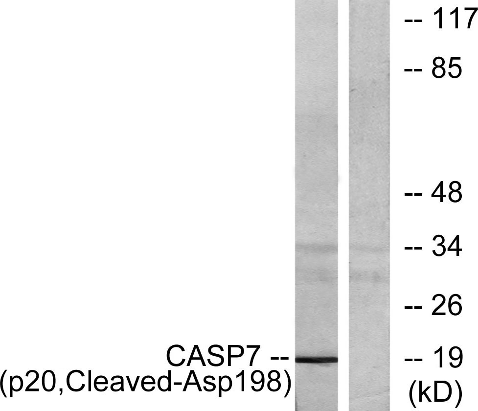 Cleaved-Caspase-7 p20 (D198)兔多抗,Cleaved-Caspase-7 p20 (D198) Rabbit Polyclonal Antibody
