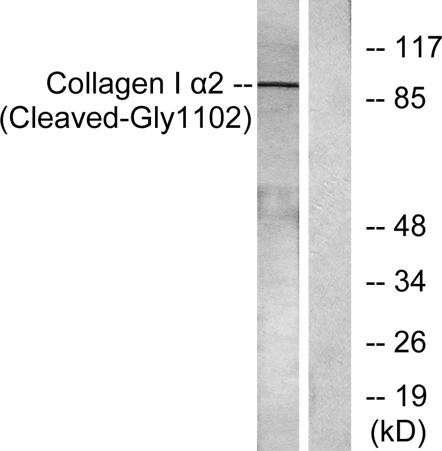 Cleaved-COL1A2 (G1102)兔多抗,Cleaved-COL1A2 (G1102) Rabbit Polyclonal Antibody
