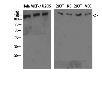 Collagen IV 兔多抗,Collagen IV  Rabbit Polyclonal Antibody