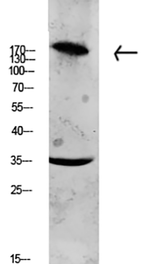 Collagen XI α1兔多抗,Collagen XI α1 Rabbit Polyclonal Antibody