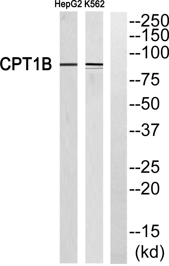 CPTI-M兔多抗,CPTI-M Rabbit Polyclonal Antibody