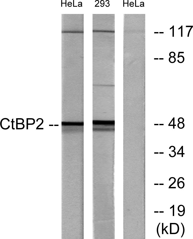 CtBP2兔多抗,CtBP2 Rabbit Polyclonal Antibody
