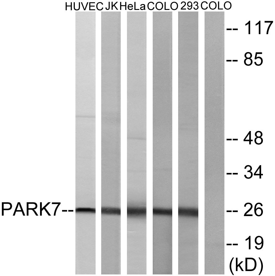DJ-1兔多抗,DJ-1 Rabbit Polyclonal Antibody