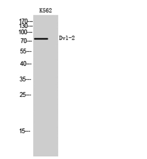 Dvl-2兔多抗,Dvl-2 Rabbit Polyclonal Antibody