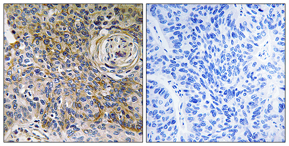 EMMPRIN兔多抗,EMMPRIN Rabbit Polyclonal Antibody