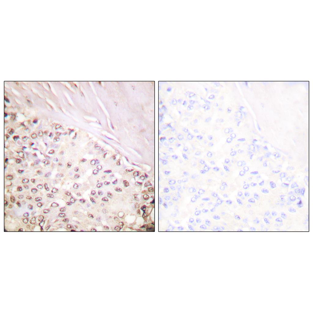 FANCD2兔多抗,FANCD2 Rabbit Polyclonal Antibody