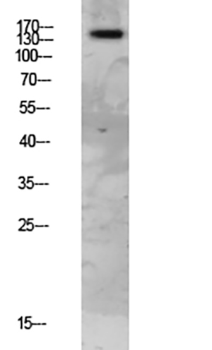 FAP-1兔多抗,FAP-1 Rabbit Polyclonal Antibody