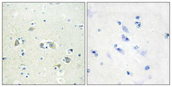 Gas6兔多抗,Gas6 Rabbit Polyclonal Antibody