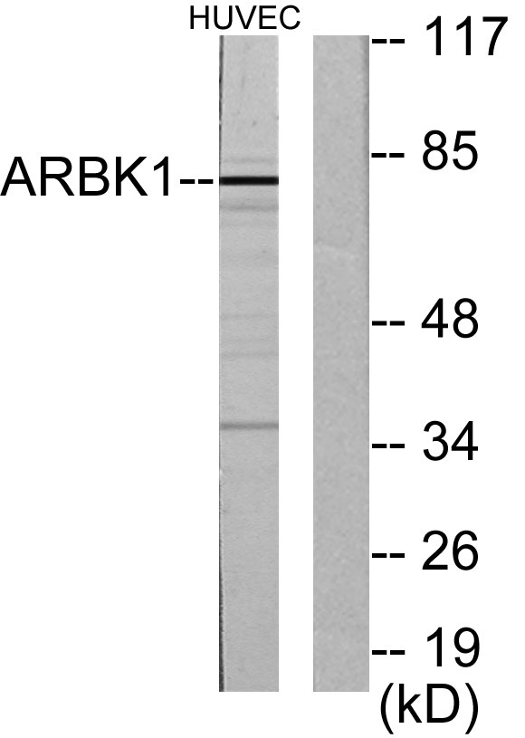 GRK 2兔多抗,GRK 2 Rabbit Polyclonal Antibody