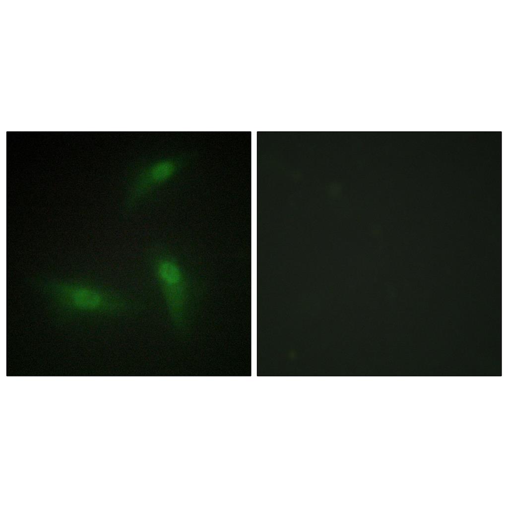 hnRNP A1兔多抗,hnRNP A1 Rabbit Polyclonal Antibody
