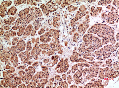HPA1兔多抗,HPA1 Rabbit Polyclonal Antibody