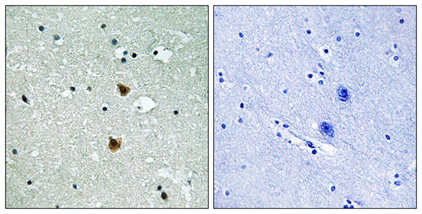 HSP27兔多抗,HSP27 Rabbit Polyclonal Antibody