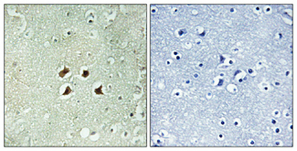 Huntingtin兔多抗,Huntingtin Rabbit Polyclonal Antibody